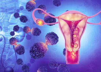 Santé : Cause, conséquence et mode de prévention  du cancer du  col de l’utérus, tout savoir avec docteur Ben Youssouf Keïta