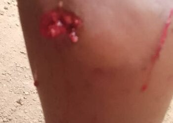 Kerouané: Des chiens errants font des victimes dans la ville