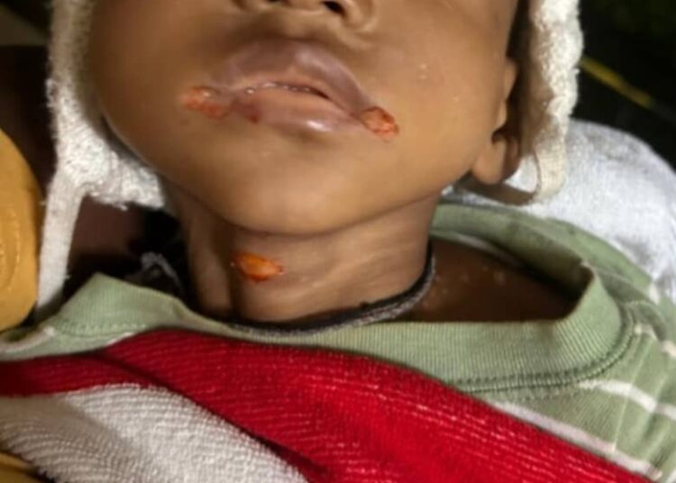 Donka: le bébé rejeté par des médecins meurt faute de prise en charge